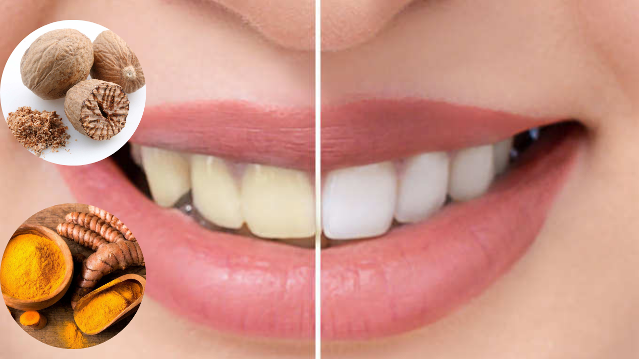 பற்களை வீட்டுல இருக்குற இந்த பொருட்களை வச்சே பளிச்சுன்னு மாத்திடலாம்!!!